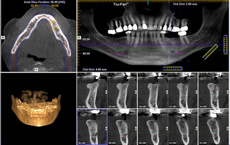 cbct vs ct scan|Dental Cone Beam Computed Tomography.